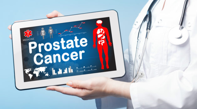 prostate cancer