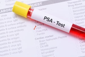 PSA test