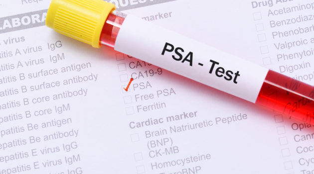 PSA test