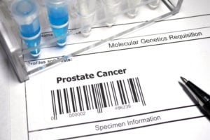 prostate cancer