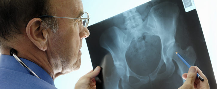 bone X-ray