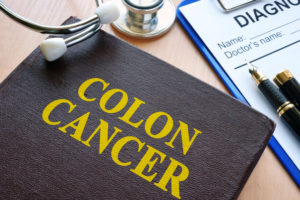 Colon Cancer