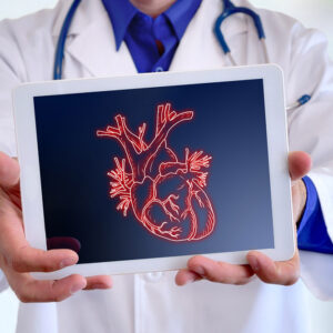 Image of a Doctor holding up heart xray
