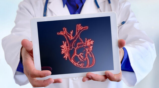 Image of a Doctor holding up heart xray