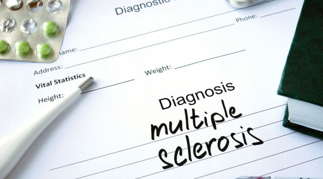 Doctor's diagnosis pad of paper with the words multiple sclerosis or MS written on it