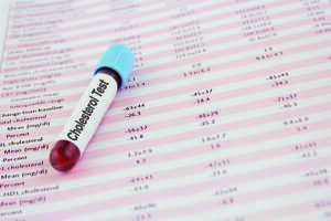 test tube with blood sample on top of blood analysis