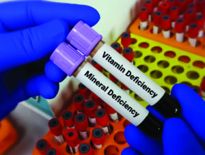 Scientist hold two blood samples for Vitamin deficiency Mineral deficiency test