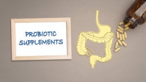 Large intestine diagram with the words probiotic supplements.