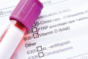 Blood sample with requisition form for vitamin D test